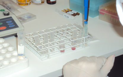 Cetebio quer expandir atuação com células e tecidos por meio do SUS