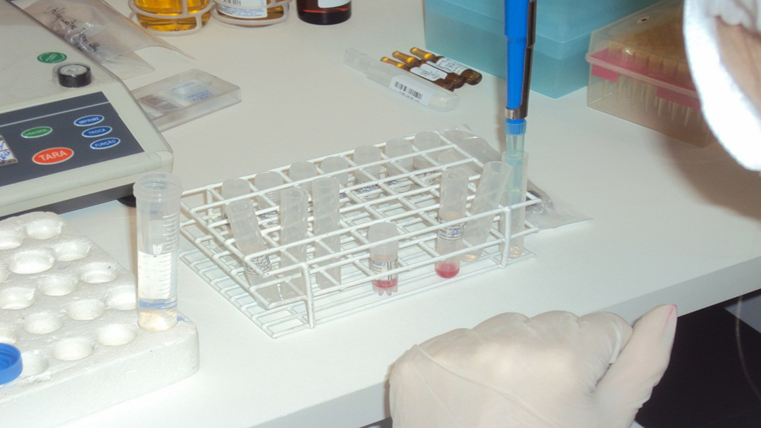 Cetebio quer expandir atuação com células e tecidos por meio do SUS