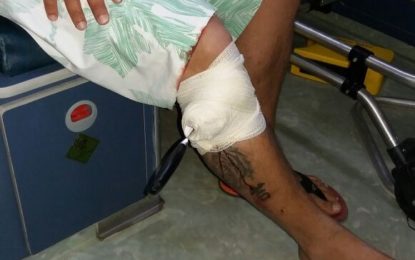 HOMEM É AGREDIDO E TEM FACA EMPALADA NA PERNA