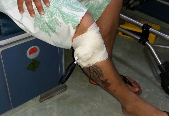 HOMEM É AGREDIDO E TEM FACA EMPALADA NA PERNA