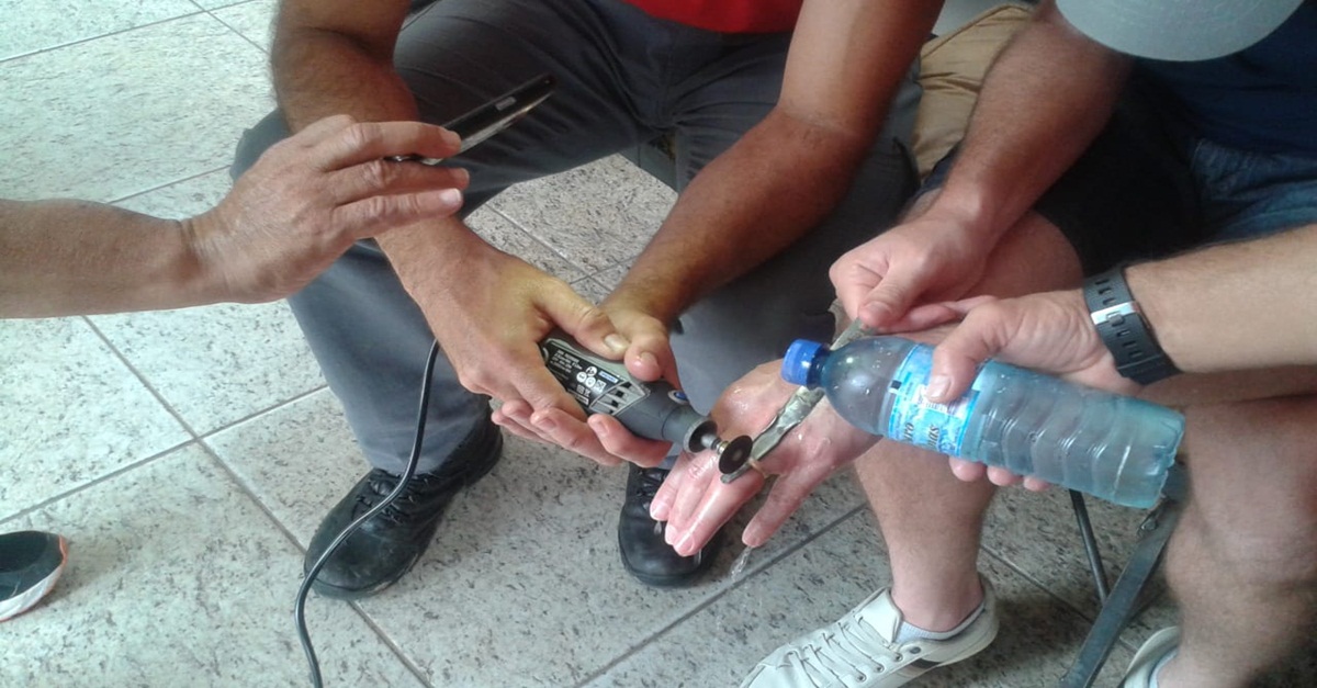 Bombeiros atendem muitas ocorrências de pessoas com o dedo estrangulado por anéis