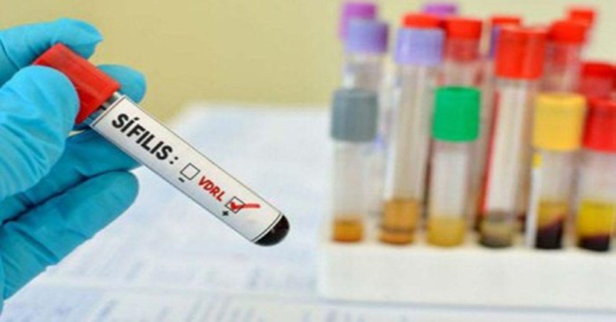 SES-MG reforça importância da prevenção e controle da sífilis