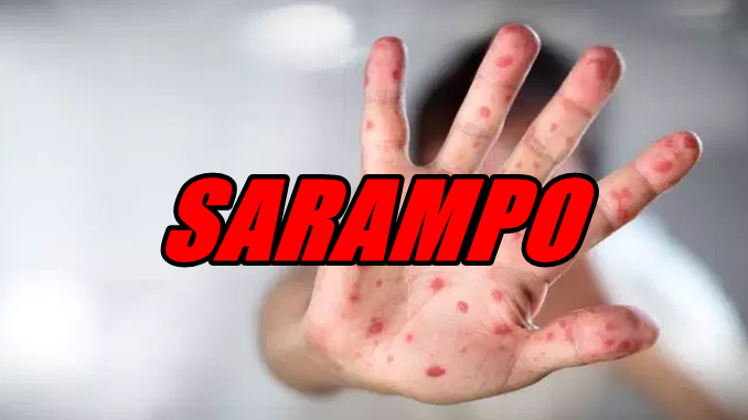 Campanha Nacional de Vacinação contra o Sarampo