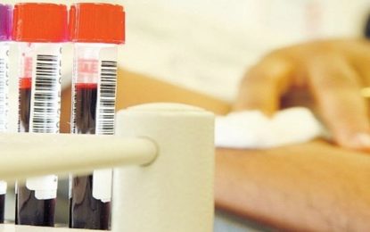 Fiocruz estuda amostras do novo coronavírus para aperfeiçoar método de identificação