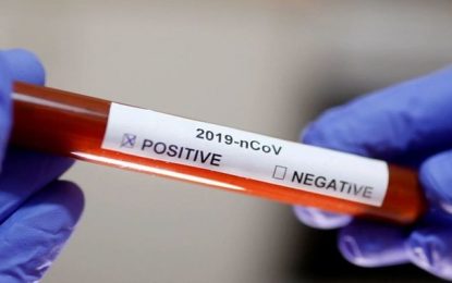 Abalo mental por conta do coronavírus é maior em mulheres