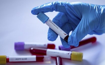 Barbacena confirma 17 novos casos de COVID-19