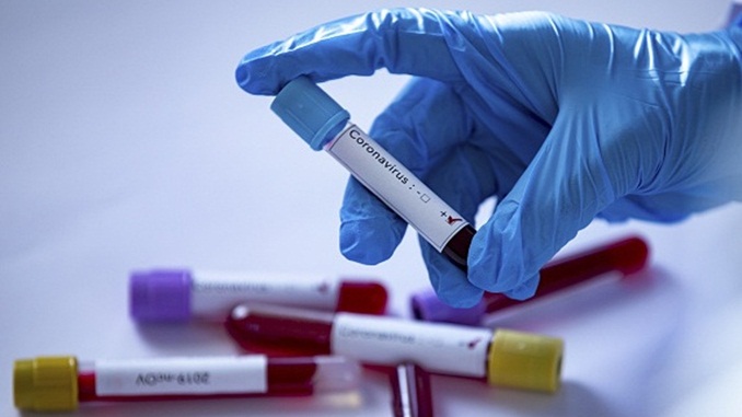 Barbacena confirma 17 novos casos de COVID-19