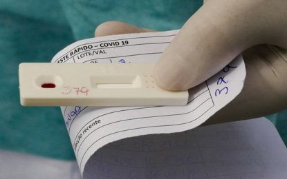 Ministério da Saúde anuncia a aquisição de 46 milhões de testes para diagnóstico da Covid-19