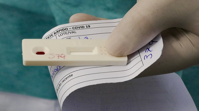 Ministério da Saúde anuncia a aquisição de 46 milhões de testes para diagnóstico da Covid-19