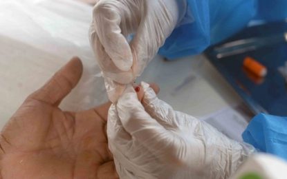 Brasil registra 374,8 mil casos confirmados da Covid-19