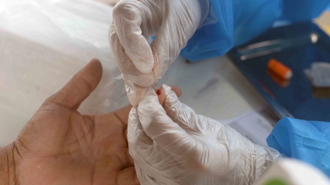 Brasil registra 374,8 mil casos confirmados da Covid-19