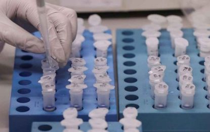 Casos confirmados da Covid-19 se aproximam de 3 mil em Minas