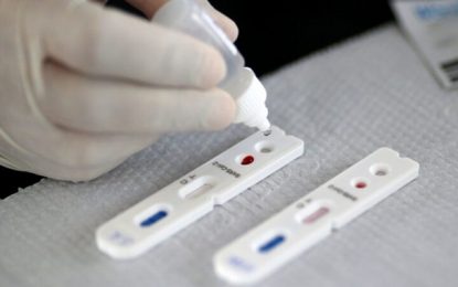 Minas Gerais é o segundo estado que menos testa a Covid-19 no Brasil