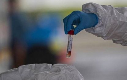 Brasil registra cerca de 500 mil casos de Covid-19; 200 mil pacientes já foram curados da doença