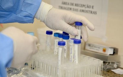 Infectados com a Covid-19 devem repetir exame diagnóstico após 14 dias do contágio, diz especialista