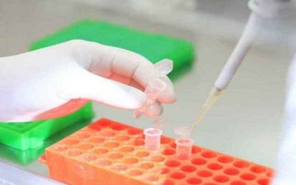 UFMG atua no desenvolvimento de vacina, novos testes e monitoramento do novo coronavírus