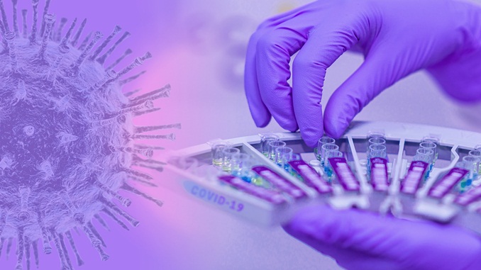 Minas Gerais tem 399 mortes e 16.102 casos de Covid-19 confirmados pelo Estado