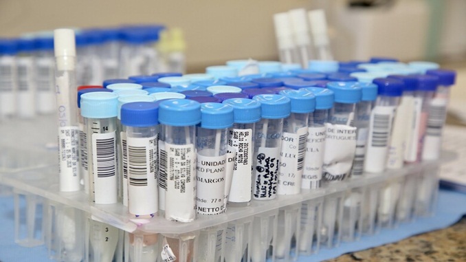 54% do total de infectados pelo Covid-19 no Brasil estão recuperados