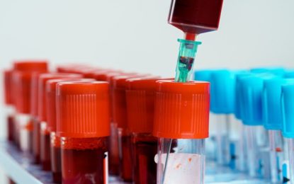 Brasil registra mais de 555 mil casos de Covid-19