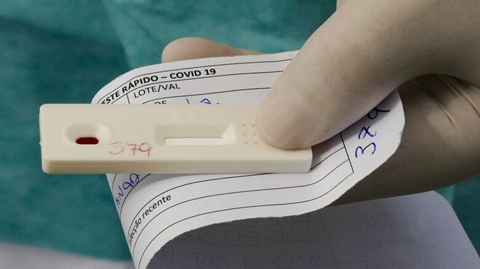 Brasil ultrapassa dois milhões de casos de Covid-19, mortes são mais de 76 mil