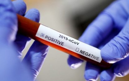 Secretaria de Saúde confirma 27 casos de Covid-19 em presídio de Buritis