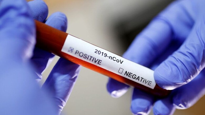 Centro-Oeste: número de casos da Covid-19 mais do que triplica nos últimos 30 dias