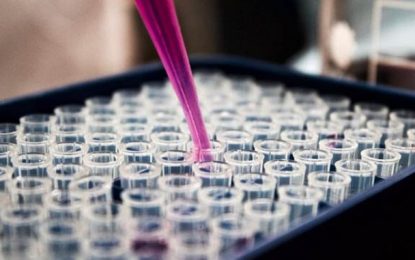 SES-MG habilita laboratórios e amplia testagem