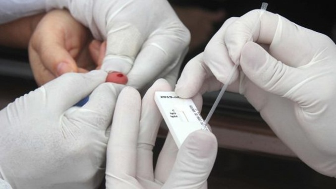 Quase 30 cidades do Sul de Minas vão aplicar testes rápidos na população