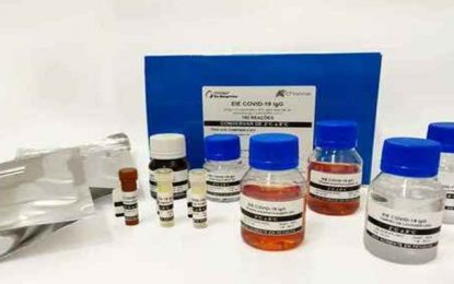 Parceria entre UFMG e Bio-Manguinhos conclui primeiro lote de kit sorológico para testes de covid-19