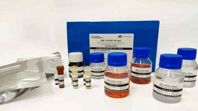 Parceria entre UFMG e Bio-Manguinhos conclui primeiro lote de kit sorológico para testes de covid-19