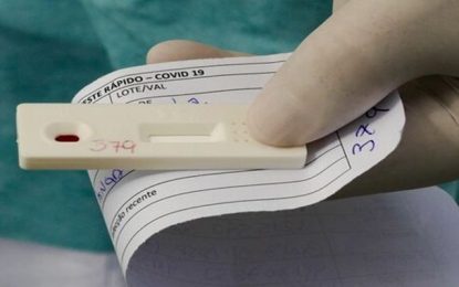 Planos de saúde são obrigados a fornecer testes de covid-19