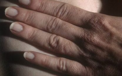 Pandemia reduz exames de mama no SUS em 62%, diz pesquisa