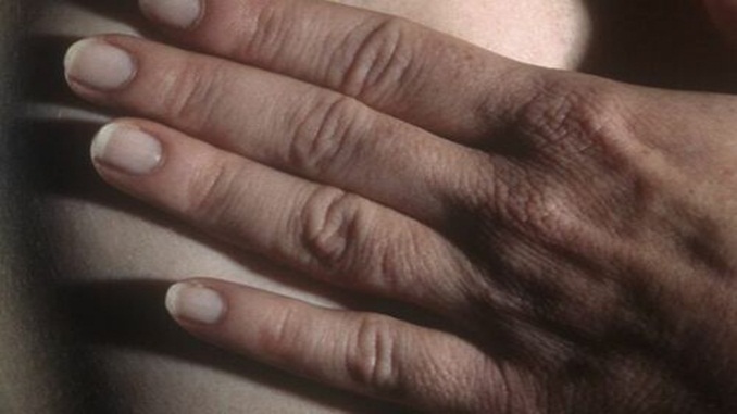 Pandemia reduz exames de mama no SUS em 62%, diz pesquisa