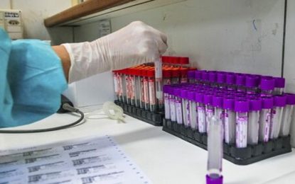 Pesquisa aponta provável ligação entre Covid-19 e disfunção erétil