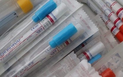 Teste rápido para detecção de covid-19 usa inteligência artificial