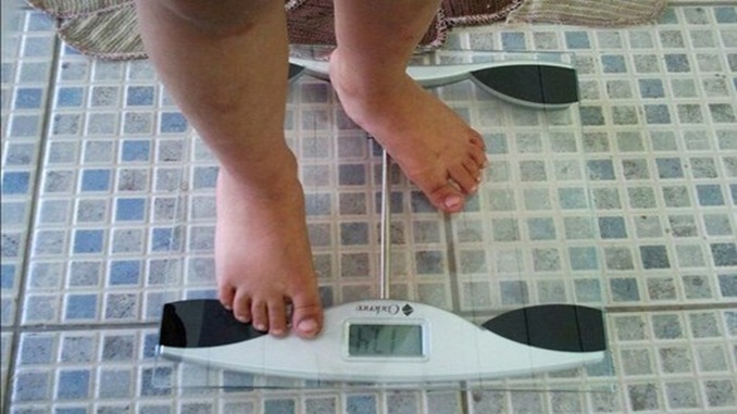 Dia Mundial da Obesidade é oportunidade para alertar sobre os riscos e falta de informação sobre a doença