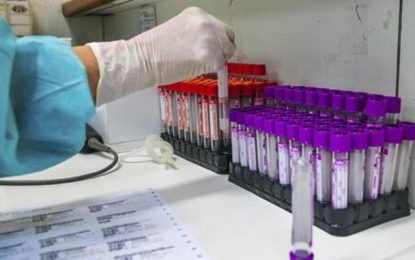 Lei que destina recursos para testes de vacinas nacionais de Covid é sancionada