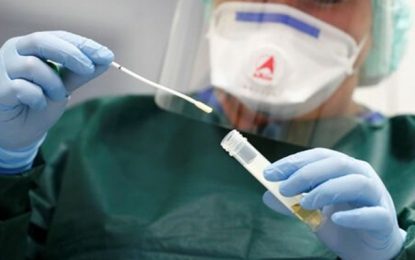 Planos de saúde são obrigados a cobrir testes de detecção da Covid-19