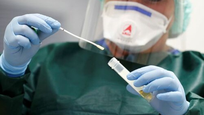 Planos de saúde são obrigados a cobrir testes de detecção da Covid-19